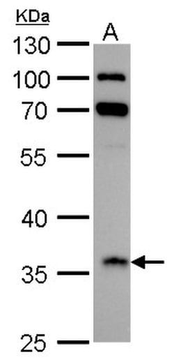 Invitrogen IGFBP2 Polyclonal Antibody 100 &mu;L; Unconjugated:Antibodies,
