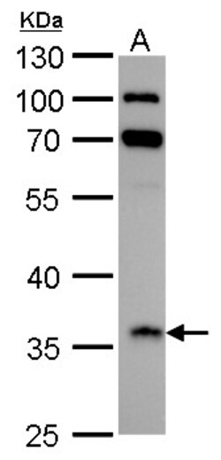 Invitrogen IGFBP2 Polyclonal Antibody 100 &mu;L; Unconjugated:Antibodies,