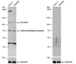 Invitrogen HGF Polyclonal Antibody 100 &mu;L; Unconjugated:Antibodies,