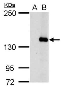 Invitrogen JARID2 Polyclonal Antibody 100 &mu;L; Unconjugated:Antibodies,