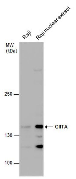 CIITA Polyclonal Antibody:Antibodies, Polyclonal