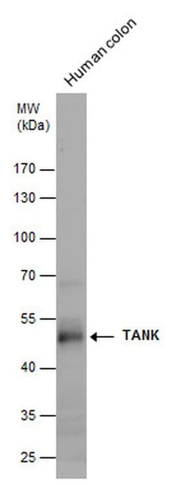 Invitrogen TANK Polyclonal Antibody 100 &mu;L; Unconjugated:Antibodies,