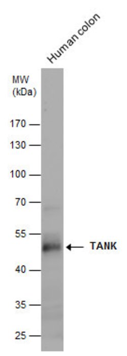 Invitrogen TANK Polyclonal Antibody 100 &mu;L; Unconjugated:Antibodies,