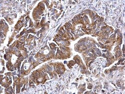 Invitrogen ATG16L1 Polyclonal Antibody 100 &mu;L | Buy Online | Invitrogen&trade; | Fisher Scientific