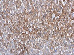 Invitrogen ATG16L1 Polyclonal Antibody 100 &mu;L | Buy Online | Invitrogen&trade; | Fisher Scientific