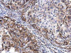 Invitrogen TGF alpha Polyclonal Antibody 100 &mu;L; Unconjugated:Antibodies,