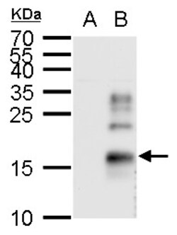 Invitrogen TGF alpha Polyclonal Antibody 100 &mu;L; Unconjugated:Antibodies,