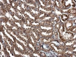 Invitrogen IGF2 Polyclonal Antibody 100 &mu;L; Unconjugated:Antibodies,