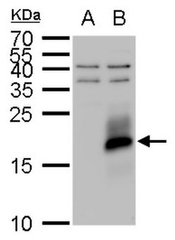 Invitrogen IGF2 Polyclonal Antibody 100 &mu;L; Unconjugated:Antibodies,