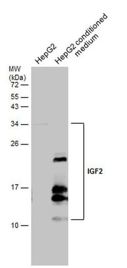Invitrogen IGF2 Polyclonal Antibody 100 &mu;L; Unconjugated:Antibodies,