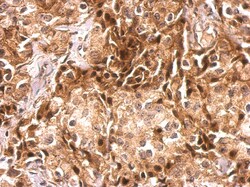 Invitrogen CDR2 Polyclonal Antibody 100 &mu;L; Unconjugated:Antibodies,