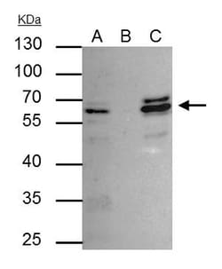 Invitrogen CDR2 Polyclonal Antibody 100 &mu;L; Unconjugated:Antibodies,