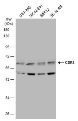 Invitrogen CDR2 Polyclonal Antibody 100 &mu;L; Unconjugated:Antibodies,