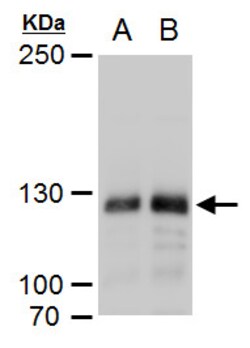 Invitrogen DNMT3A Polyclonal Antibody 100 &mu;L; Unconjugated:Antibodies,