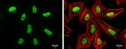 Invitrogen DNMT3B Polyclonal Antibody 100 &mu;L; Unconjugated:Antibodies,