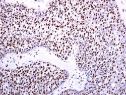 Invitrogen DNMT3B Polyclonal Antibody 100 &mu;L; Unconjugated:Antibodies,
