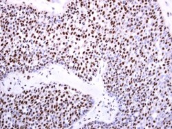 Invitrogen DNMT3B Polyclonal Antibody 100 &mu;L; Unconjugated:Antibodies,