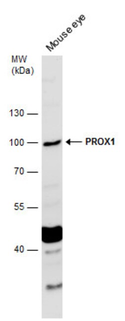 Invitrogen PROX1 Polyclonal Antibody 100 &mu;L; Unconjugated:Antibodies,