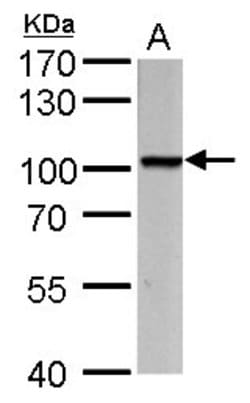 Invitrogen PROX1 Polyclonal Antibody 100 &mu;L; Unconjugated:Antibodies,