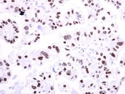 TCF2 Polyclonal Antibody:Antibodies, Polyclonal