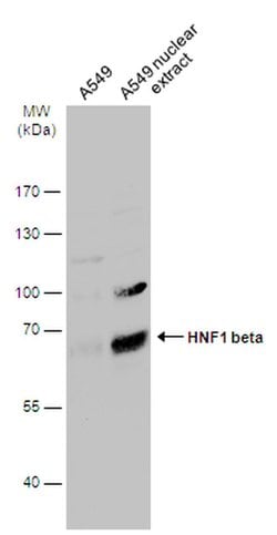 TCF2 Polyclonal Antibody:Antibodies, Polyclonal