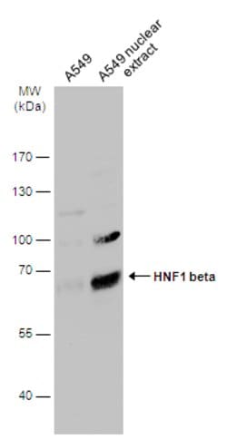 TCF2 Polyclonal Antibody:Antibodies, Polyclonal