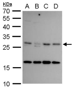 Invitrogen CITED2 Polyclonal Antibody 100 &mu;L; Unconjugated:Antibodies,