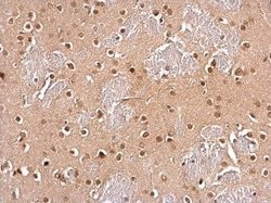Invitrogen UBC9 Polyclonal Antibody 100 &mu;L; Unconjugated:Antibodies,