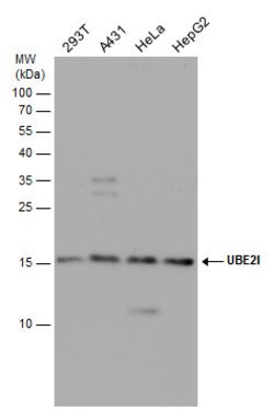 Invitrogen UBC9 Polyclonal Antibody 100 &mu;L; Unconjugated:Antibodies,