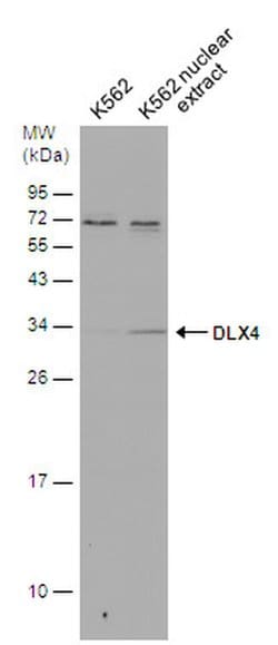 Invitrogen DLX4 Polyclonal Antibody 100 &mu;L; Unconjugated:Antibodies,
