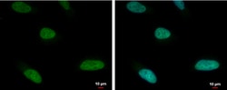 Invitrogen&trade;&nbsp;ARID1A Polyclonal Antibody