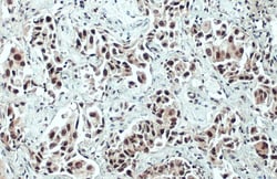 Invitrogen ARID1A Polyclonal Antibody 100 &mu;L | Buy Online | Invitrogen&trade; | Fisher Scientific