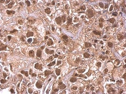 Invitrogen ARID1A Polyclonal Antibody 100 &mu;L | Buy Online | Invitrogen&trade; | Fisher Scientific