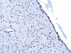 Invitrogen ARID1A Polyclonal Antibody 100 &mu;L | Buy Online | Invitrogen&trade; | Fisher Scientific