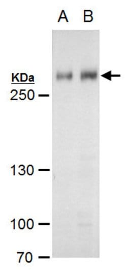 Invitrogen ARID1A Polyclonal Antibody 100 &mu;L | Buy Online | Invitrogen&trade; | Fisher Scientific