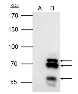 Invitrogen IKAROS Polyclonal Antibody 100 &mu;L; Unconjugated:Antibodies,