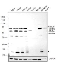 Invitrogen IKAROS Polyclonal Antibody 100 &mu;L; Unconjugated:Antibodies,