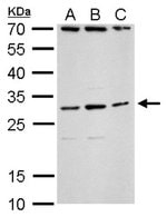 TLX3 Polyclonal Antibody, Invitrogen™