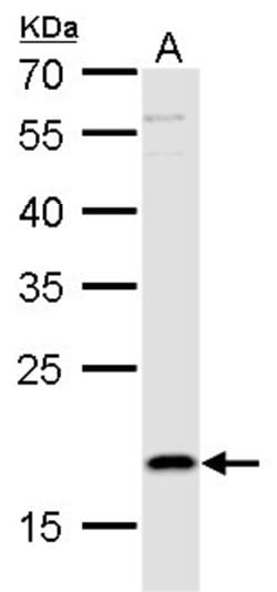 Invitrogen TSLP Polyclonal Antibody 100 &mu;L; Unconjugated:Antibodies,
