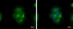 Invitrogen S100A9 Polyclonal Antibody 100 &mu;L; Unconjugated:Antibodies,
