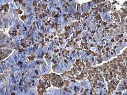 Invitrogen S100A9 Polyclonal Antibody 100 &mu;L; Unconjugated:Antibodies,