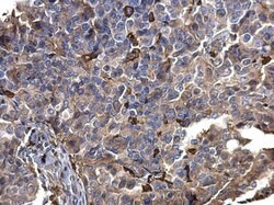 Invitrogen S100A9 Polyclonal Antibody 100 &mu;L; Unconjugated:Antibodies,