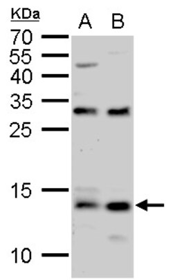 Invitrogen S100A9 Polyclonal Antibody 100 &mu;L; Unconjugated:Antibodies,
