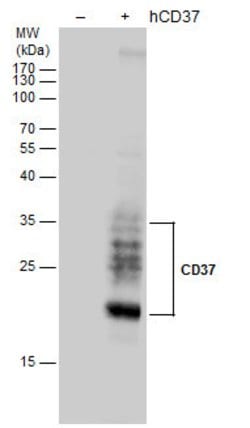 Invitrogen CD37 Polyclonal Antibody 100 &mu;L; Unconjugated:Antikroppar