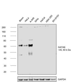 Invitrogen GATA6 Polyclonal Antibody 100 &mu;L; Unconjugated:Antibodies,