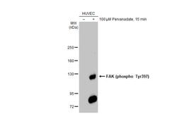 Invitrogen Phospho-FAK (Tyr397) Polyclonal Antibody 100 &mu;L; Unconjugated:Antibodies,