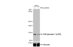 Invitrogen Phospho-FAK (Tyr397) Polyclonal Antibody 100 &mu;L; Unconjugated:Antibodies,