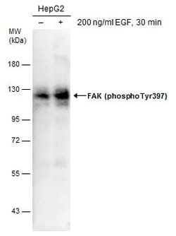 Invitrogen Phospho-FAK (Tyr397) Polyclonal Antibody 100 &mu;L; Unconjugated:Antibodies,