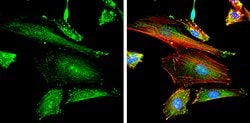 Invitrogen Phospho-FAK (Tyr397) Polyclonal Antibody 100 &mu;L; Unconjugated:Antibodies,