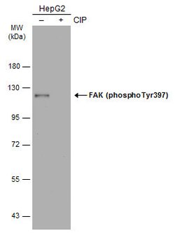 Invitrogen Phospho-FAK (Tyr397) Polyclonal Antibody 100 &mu;L; Unconjugated:Antibodies,